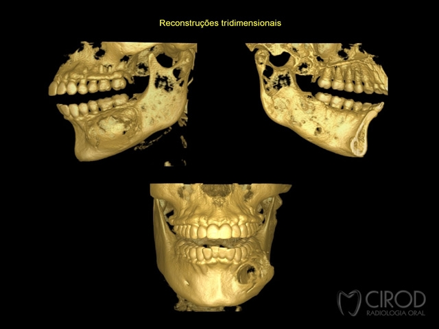 Reconstruções Tridimensionais